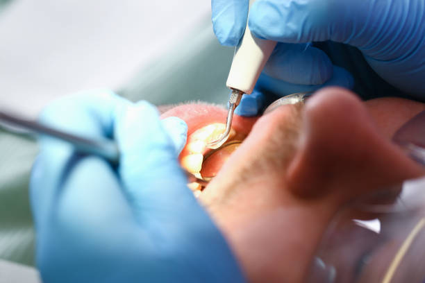 Best Dentist Open Late Near Me  in Paramount, CA