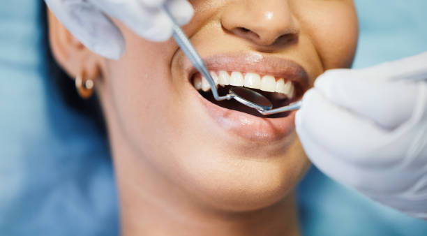 Best Dentist for Dental Trauma  in Paramount, CA